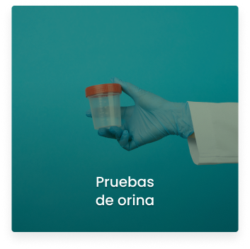 Cosmitet Ltda - Servicios pruebas de orina