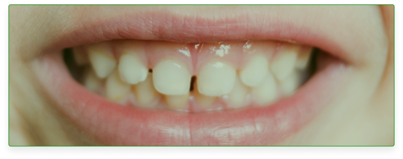 Cosmitet Ltda, Educación al usuario, salud oral